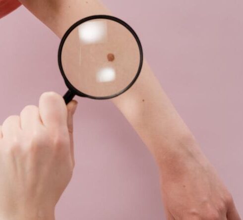 Skin Health - Person Holding Magnifying Glass With White Background