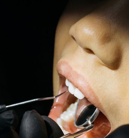 Checkups - Close-Up Shot of a Kid Having Dental Checkup