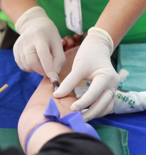 Treatment - Person Getting His Blood Check