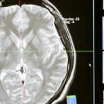 Brain Health - Free stock photo of analysis, anatomy, brain