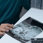 Digital Filing - Close-Up Shot of a Person Holding an X-ray Image