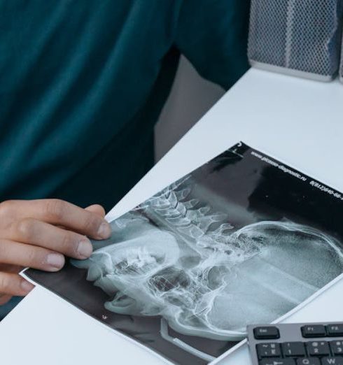 Digital Filing - Close-Up Shot of a Person Holding an X-ray Image